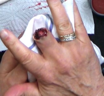 SFX Wounds